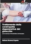 Los mejores productos para cuidar la condromalacia degenerativa en la práctica de tus deportes favoritos